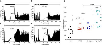 Expression and Activation of BKCa Channels in Mice Protects Against Ischemia-Reperfusion Injury of Isolated Hearts by Modulating Mitochondrial Function